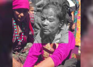 प्रेसर कुकर पड्किँदा एक महिला घाइते